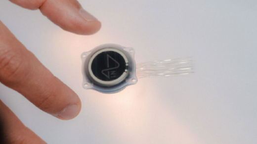 马斯克征召40岁以下志愿者 需同意让微型芯片植入大脑