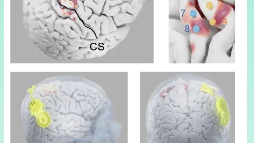 中国脑机接口新突破，清华大学团队实现高位截瘫患者脑控光标
