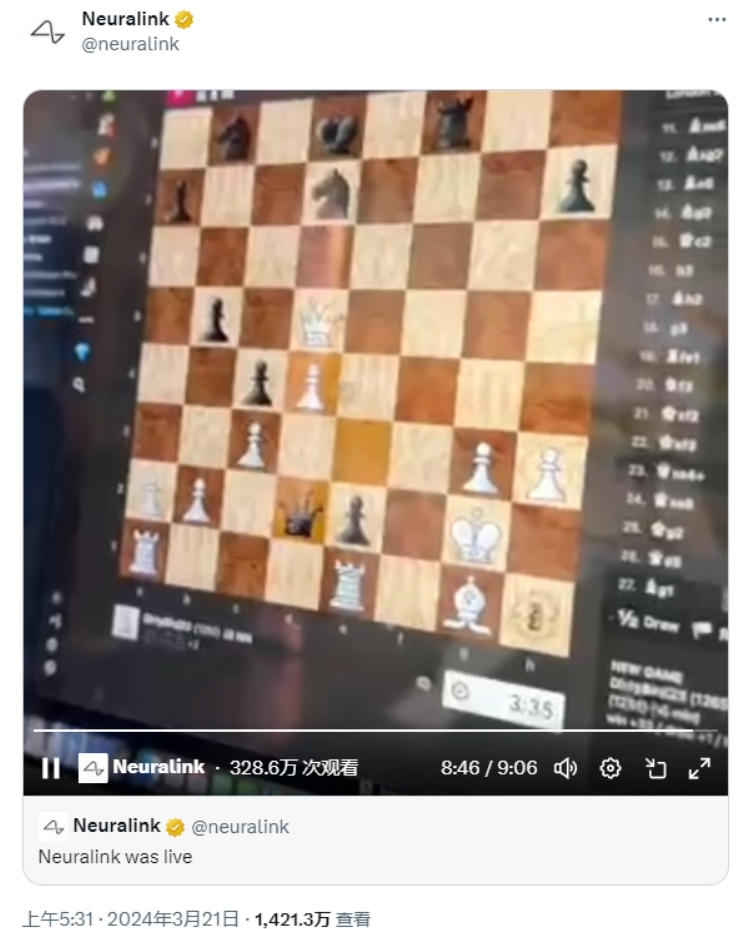 脑机接口首位受试者实现用意念发帖,马斯克进行回复