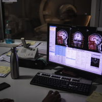 马斯克脑机接口竞争对手 Precision 融资 9300 万美元，估值达 5 亿美元