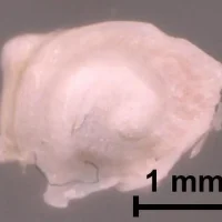 最新成像技术让医疗人员无需解剖就能看到内耳的细节