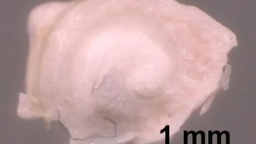 最新成像技术让医疗人员无需解剖就能看到内耳的细节