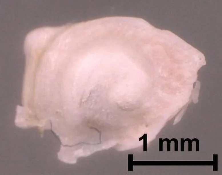最新成像技术让医疗人员无需解剖就能看到内耳的细节
