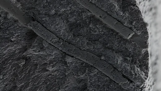 印度科学家发明可治愈牙齿敏感的微型机器人CalBot