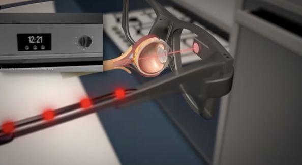 英国研发出PRIMA电子眼 84%失明患者恢复阅读能力