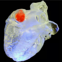 科学家发明新型超声波 3D 打印技术，可实现植入物体内直接打印