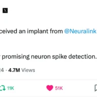 马斯克：首位人类已接受 Neuralink 脑机芯片植入手术，患者恢复良好