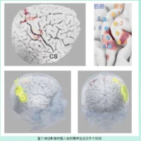 中国脑机接口新突破，清华大学团队实现高位截瘫患者脑控光标