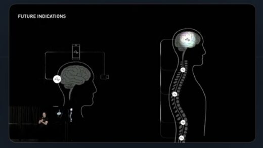 马斯克脑机接口实验新进展：首位患者能用意念下棋了