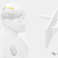 Neuralink 劲敌 Precision 破纪录：4096 个电极微创植入人脑，脑机接口有望进入「5G」时代