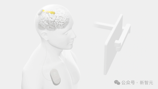 Neuralink 劲敌 Precision 破纪录：4096 个电极微创植入人脑，脑机接口有望进入「5G」时代