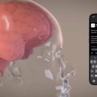 马斯克脑机接口公司 Neuralink：首位患者芯片植入物的细线现已稳定