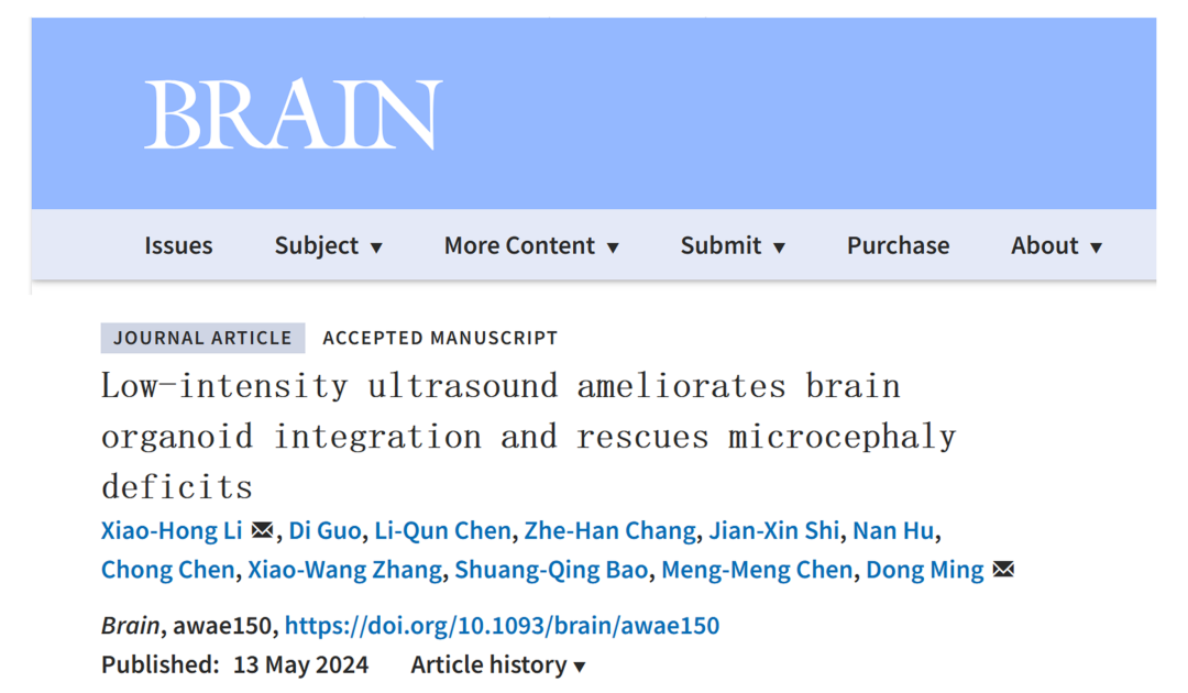 全球首个“人脑”控制机器人,天津大学新成果登上顶刊《Brain》 图片