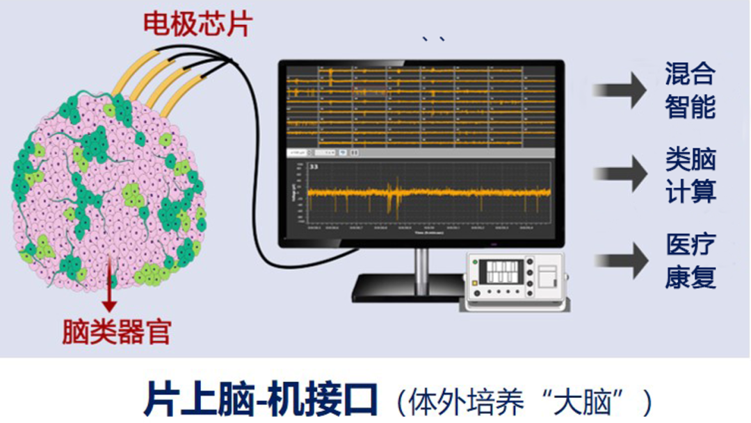 全球首个“人脑”控制机器人,天津大学新成果登上顶刊《Brain》 图片