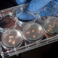 科学家培育出“迷你大脑”，最终会产生意识吗