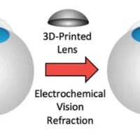 科学家开发出无需进行LASIK等手术即可矫正视力的方法