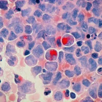 Google与耶鲁大学的新型AI系统刚刚取得重大癌症突破