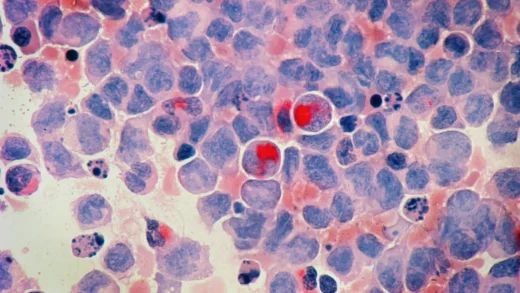 Google与耶鲁大学的新型AI系统刚刚取得重大癌症突破