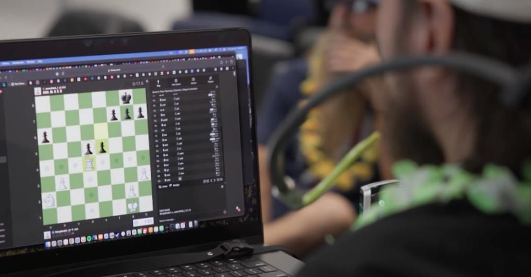 挑战Neuralink，硅谷大佬争相涌入的超声脑机接口是什么？